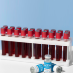 blood-collection-tubes-edta-citrate-sst-etc